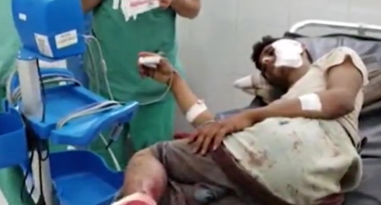 زخمی شدن ۴ غیرنظامی یمنی در حملات رژیم سعودی