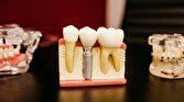 بررسی شایع‌ترین علل و درمان‌های دندان درد