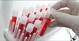درمان بیماری‌هایی که منشا خونی دارند با سلول‌های بنیادی بند خون ناف
