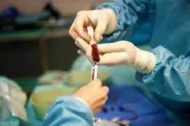 انجام بیش از ۳۰۰ عمل پیوند سلول‌های بنیادی خونساز در دانشگاه علوم پزشکی مشهد