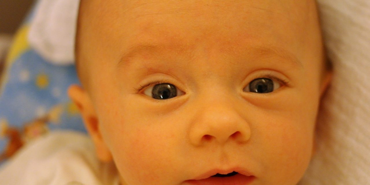 نبود مبنای علمی و مذهبی در حجامت لاله گوش نوزاد برای درمان زردی