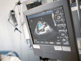 اختصاص یک دستگاه اکوکاردیوگرافی پیشرفته به دانشگاه علوم پزشکی مشهد