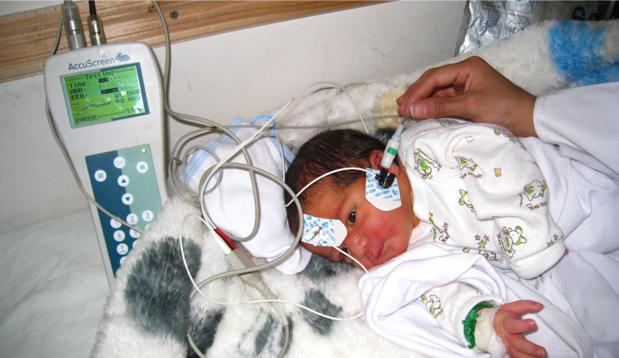 غربالگری شنوایی بیش از ۸۸ هزار نوزاد در خوزستان