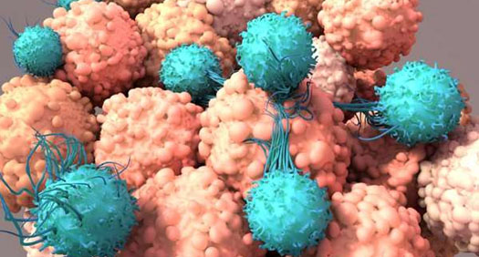 فناوری سلول‌های CAR-T رویکردی جدید برای درمان سرطان‌های جامد