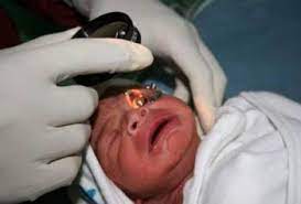 امکان معاینه دقیق چشم نوزادان در بیمارستان طالقانی اراک فراهم شد