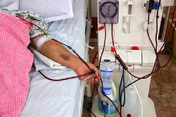  بیمه ناقص بیماران کلیوی در استان همدان