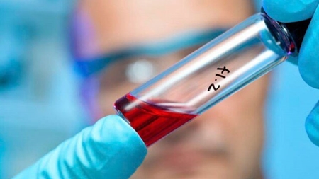 پیوند سلول‌های بنیادی خون‌ساز به کودکان با تجهیزات ایران‌ساخت