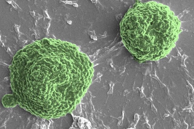 استفاده از میکروربات‌های جلبکی در درمان سرطان