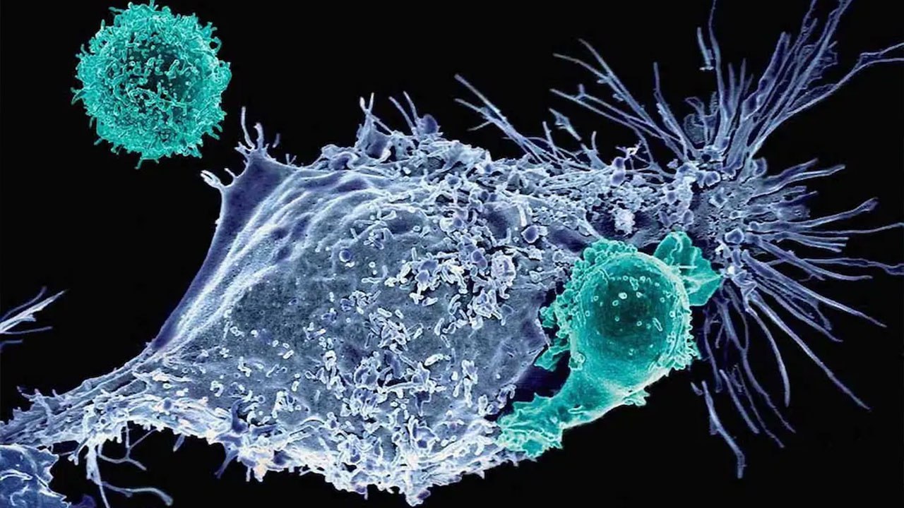 نانوذرات، ویراستار ژن را به تومور سرطانی رساندند