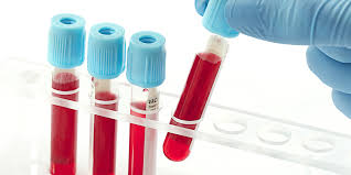انجام حدود ۲۹۰ عمل پیوند سلول‌های بنیادی خونساز در دانشگاه علوم پزشکی مشهد