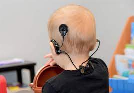 ارائه خدمات رایگان کاشت حلزون شنوایی به افراد واجد شرایط 