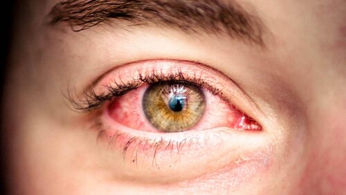 مراقبت از چشم‌ها به عنوان حساس‌ترین عضو بدن