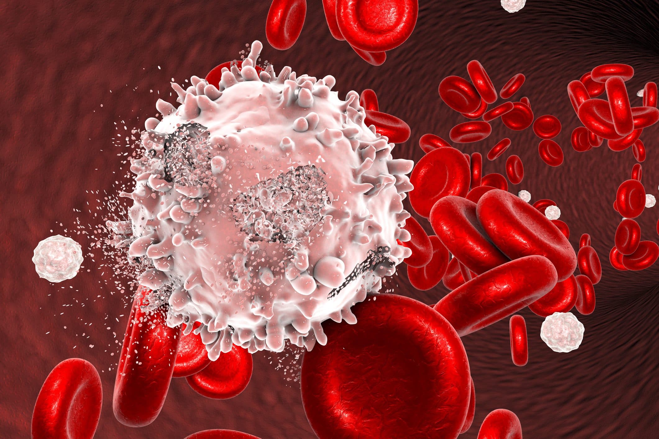 حاج آقایی// پیش بینی خطر ابتلا به سرطان خون در بیماران مبتلا به خونسازی کلونال