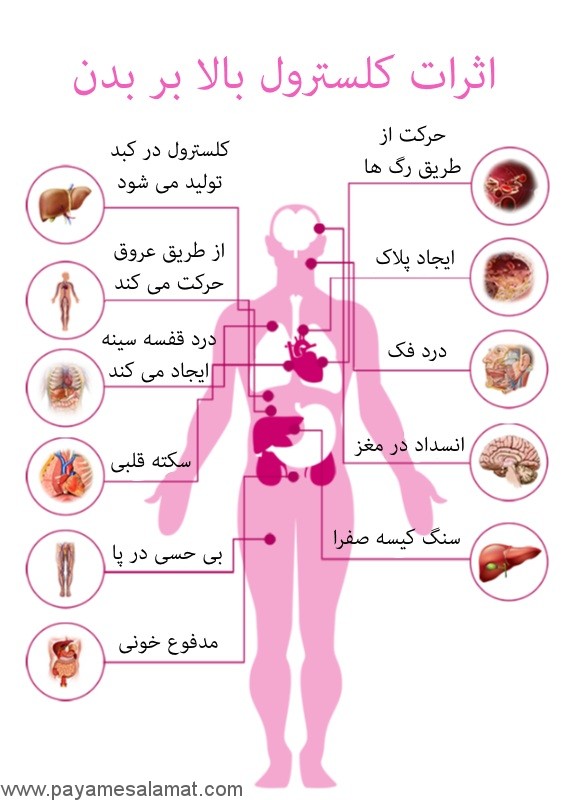 نشانه های شگفت انگیز کلسترول بالا