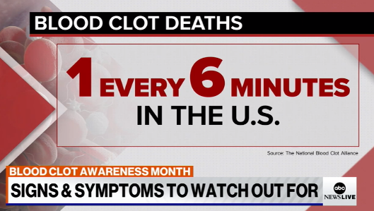 هر ۶ دقیقه، یک نفر در آمریکا بر اثر لخته شدن خون می‌میرد