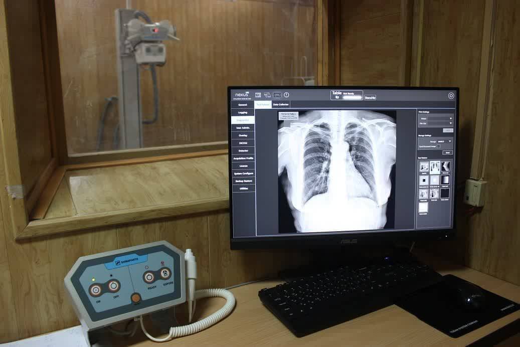 راه اندازی دومین دستگاه رادیولوژی دیجیتال در بیمارستان شهید بهشتی کاشان