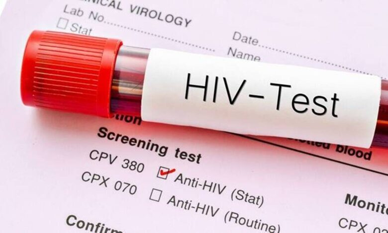 حفظ سلامت روده از پیشرفت ویروس HIV به ایدز جلوگیری می‌کند