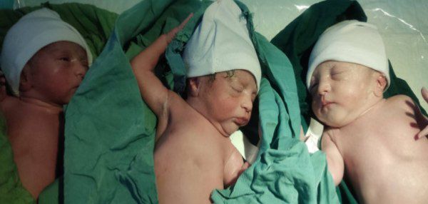 تولد سه قلوها در بیمارستان نهم دی تربت حیدریه