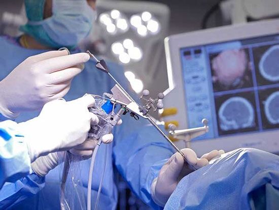 انجام موفقیت آمیز اولین جراحی مغز در اندیمشک
