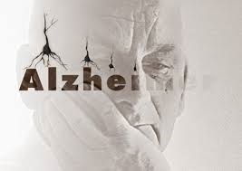 هرنوع حواس پرتی و اختلال حافظه  آلزایمر نیست