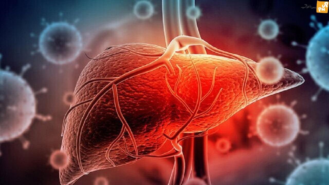 ارتباط مصرف نوشیدنی‌های مصنوعی و خطر ابتلا به بیماری کبدی