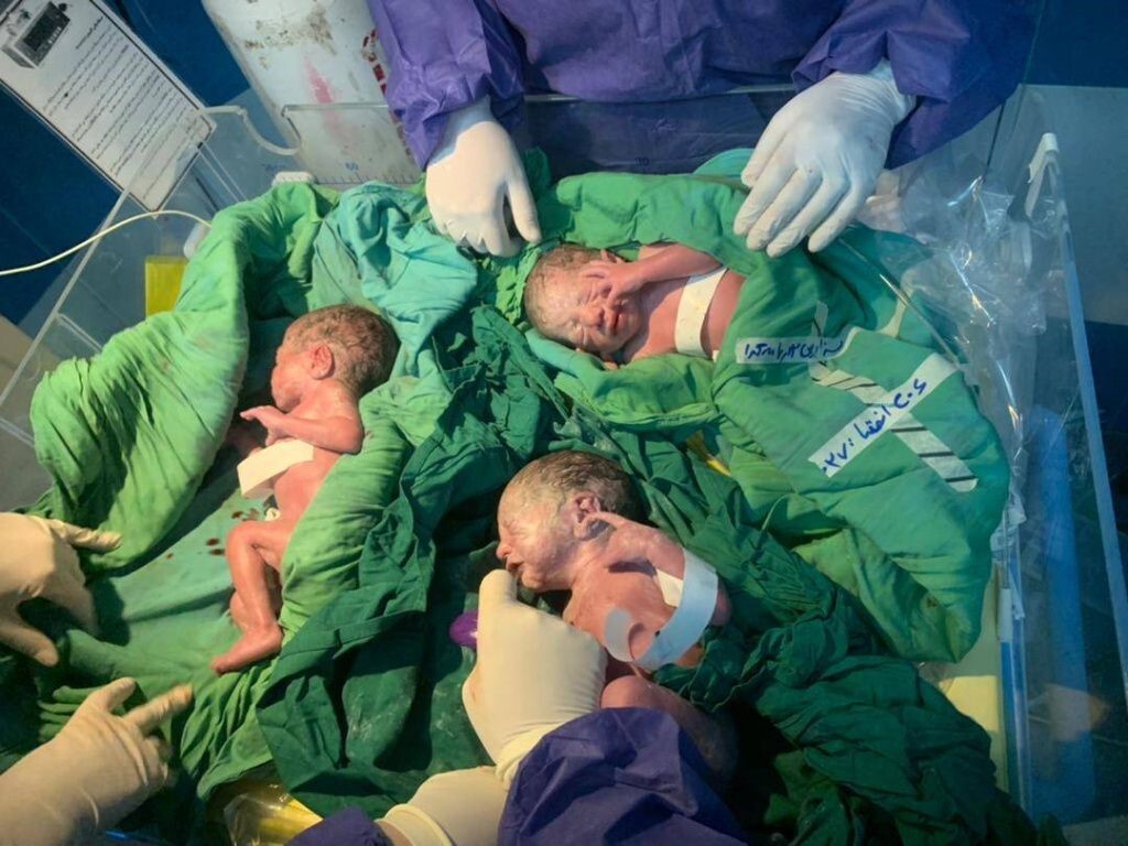 تولد سه قلو‌ها در بیمارستان نهم دی تربت حیدریه