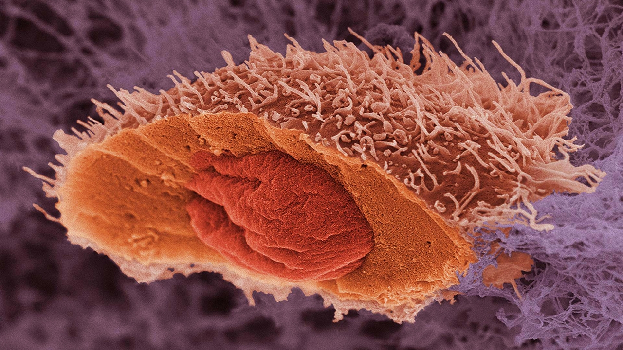 تحول در درمان سرطان با استفاده از فناوری نانومیله طلا (ویترین / منبع : پایگاه خبری فناوری نانو)