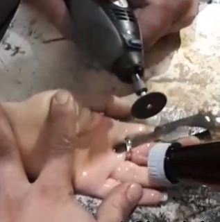 رهاسازی انگشتر دردسر ساز از دستان خانم ۱۹ ساله در دزفول