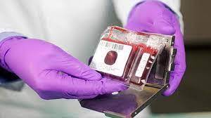 راه‌اندازی شعبه بانک خون بندناف رویان در مشگین‌شهر و پارس‌آباد