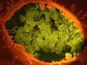  باکتری‌های روده کلید مبارزه با سرطان کولورکتال هستند( ویترین / منبع : پایگاه سلول های بنیادی ایران)