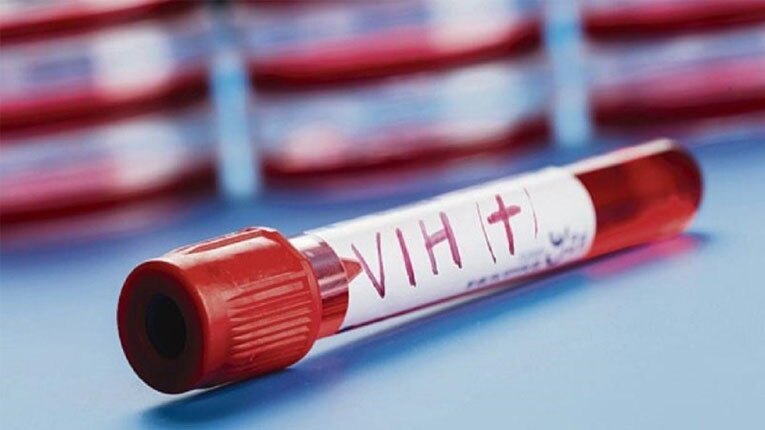 ارتقاء خدمات تشخیص HIV با مشارکت اجتماعی شعار روز جهانی ایدز