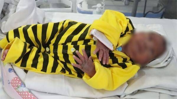ترخیص نوزاد کم وزن از بیمارستان حکیم نیشابور