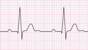 معرفی تجهیزات آزمایشگاه نوار قلب در کنگره بین‌المللی کاسپین