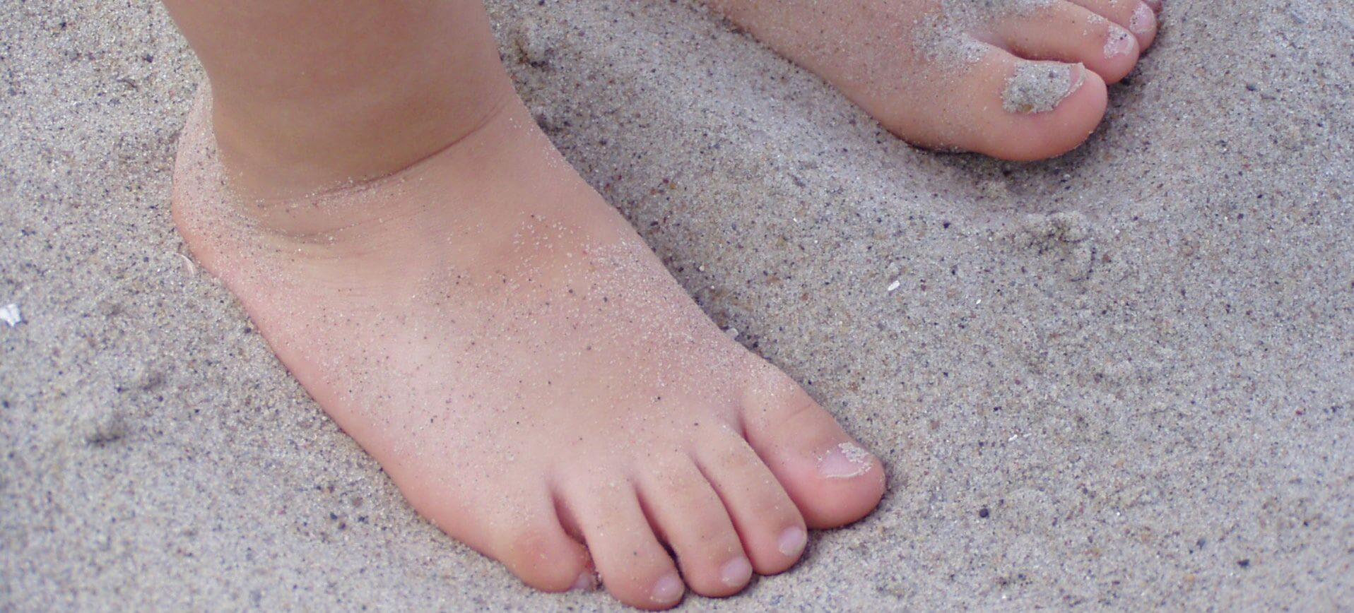 کف پای صاف شدید در کودکی نشان از بروز یک مشکل دارد