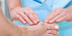 توصیه عمل جراحی به افرادی که  انحراف در انگشت شصت پا، دارند