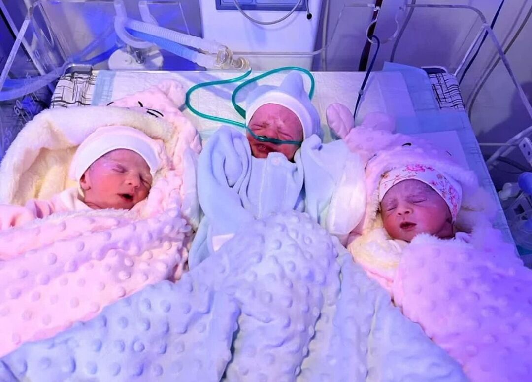 تولد سه قلو در اولین زایمان مادر سنندجی